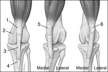 1 - Patella, 2 - Femur, 3 - Patellární vaz, 4 - Tibiální drsnatina, 5 - Mediální luxace patelly, 6 - Laterální luxace patelly